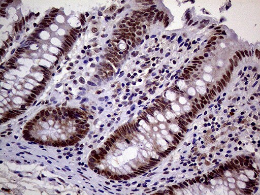 MAGEB4 Antibody (OTI3H2) Immunohistochemistry;MAGEB4 Antibody (OTI3H2)[NBP3-44915]-