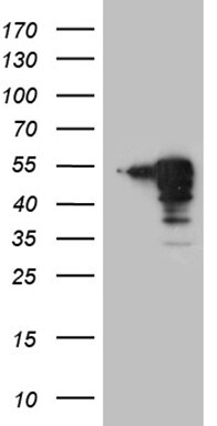 MAGEB4 Antibody (OTI3H2) Western Blot;MAGEB4 Antibody (OTI3H2)[NBP3-44915]-