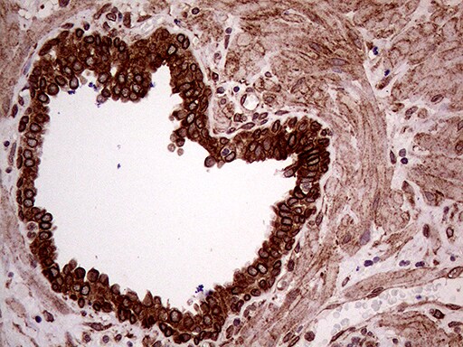 ERLIN1 Antibody (OTI4B1) Immunohistochemistry;ERLIN1 Antibody (OTI4B1)[NBP3-44916]-