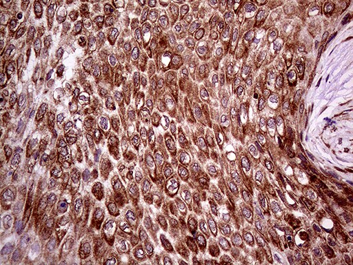 ERLIN1 Antibody (OTI4B1) Immunohistochemistry;ERLIN1 Antibody (OTI4B1)[NBP3-44916]-