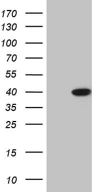 ERLIN1 Antibody (OTI4C11)