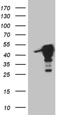 MAGEB4 Antibody (OTI3A6) Western Blot;MAGEB4 Antibody (OTI3A6)[NBP3-44920]-