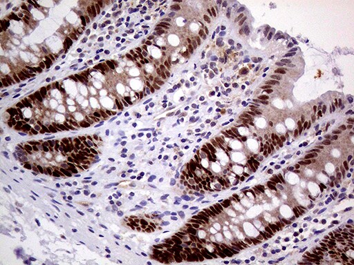 MAGEB4 Antibody (OTI1B5) Immunohistochemistry;MAGEB4 Antibody (OTI1B5)[NBP3-44925]-
