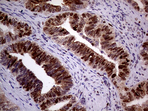 MAGEB4 Antibody (OTI1B5) Immunohistochemistry;MAGEB4 Antibody (OTI1B5)[NBP3-44925]-