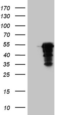 MAGEB4 Antibody (OTI1B5) Western Blot;MAGEB4 Antibody (OTI1B5)[NBP3-44925]-