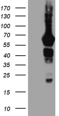 GRB7 Antibody (OTI6H2) Western Blot;GRB7 Antibody (OTI6H2)[NBP3-44930]-