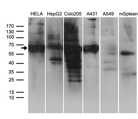 GRB7 Antibody (OTI15E7)