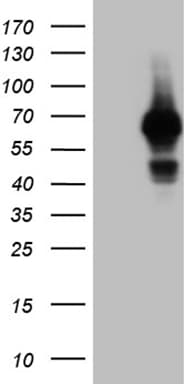 GRB7 Antibody (OTI15E7) Western Blot;GRB7 Antibody (OTI15E7)[NBP3-44931]-