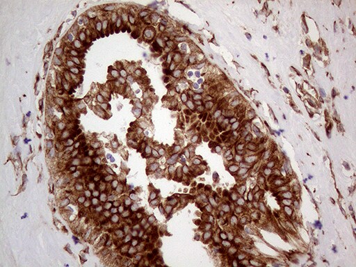 HABP2 Antibody (OTI8D6) Immunohistochemistry;HABP2 Antibody (OTI8D6)[NBP3-44933]-