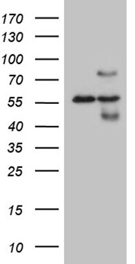 HABP2 Antibody (OTI8D6) Western Blot;HABP2 Antibody (OTI8D6)[NBP3-44933]-