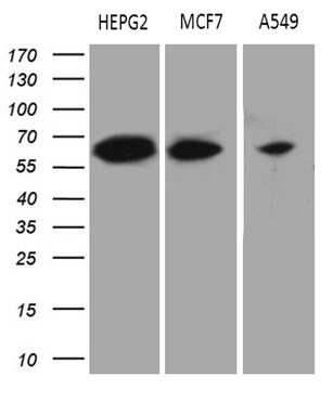 HABP2 Antibody (OTI8D6) Western Blot;HABP2 Antibody (OTI8D6)[NBP3-44933]-