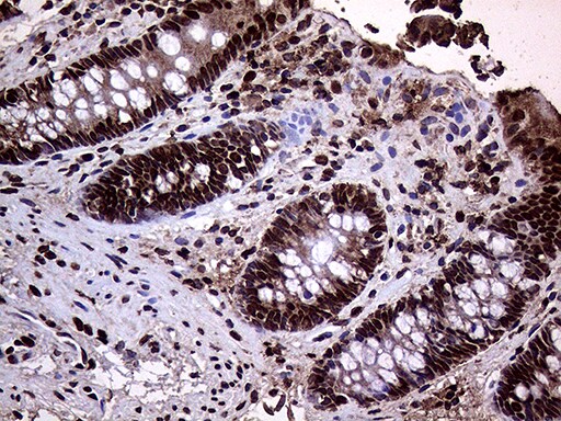 TRMT5 Antibody (OTI1B5)