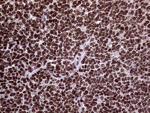 TRMT5 Antibody (OTI1B5) Immunohistochemistry;TRMT5 Antibody (OTI1B5)[NBP3-44935]-