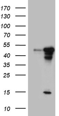 BLZF1 Antibody (OTI8E8) Western Blot;BLZF1 Antibody (OTI8E8)[NBP3-44936]-