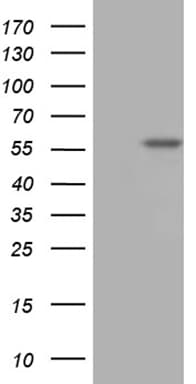 TBX20 Antibody (OTI2C7) Western Blot;TBX20 Antibody (OTI2C7)[NBP3-44938]-
