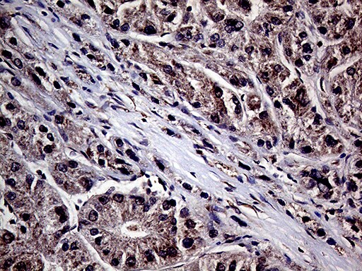 HABP2 Antibody (OTI5H3)