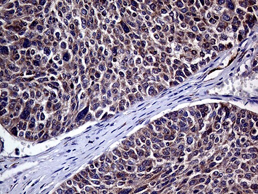 HABP2 Antibody (OTI5H3) Immunohistochemistry;HABP2 Antibody (OTI5H3)[NBP3-44939]-