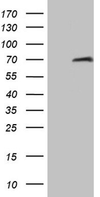 HABP2 Antibody (OTI5H3) Western Blot;HABP2 Antibody (OTI5H3)[NBP3-44939]-