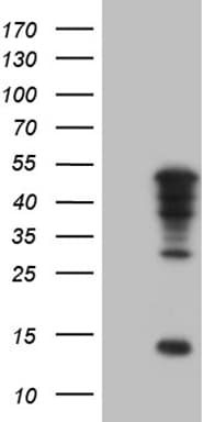 TBX20 Antibody (OTI6C9) Western Blot;TBX20 Antibody (OTI6C9)[NBP3-44941]-