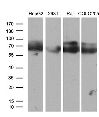 CACNB1 Antibody (OTI3H6) Western Blot;CACNB1 Antibody (OTI3H6)[NBP3-44945]-