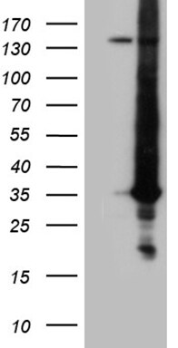 RAB23 Antibody (OTI2A8) Western Blot;RAB23 Antibody (OTI2A8)[NBP3-44946]-