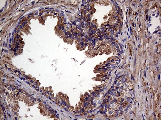 RAB23 Antibody (OTI4C7) Immunohistochemistry;RAB23 Antibody (OTI4C7)[NBP3-44949]-