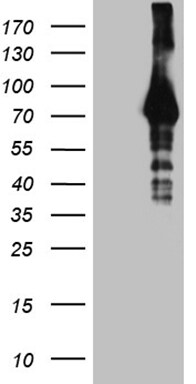 HABP2 Antibody (OTI4G9) Western Blot;HABP2 Antibody (OTI4G9)[NBP3-44950]-
