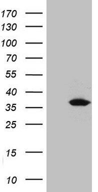 UCK2 Antibody (OTI21A6) Western Blot;UCK2 Antibody (OTI21A6)[NBP3-44951]-
