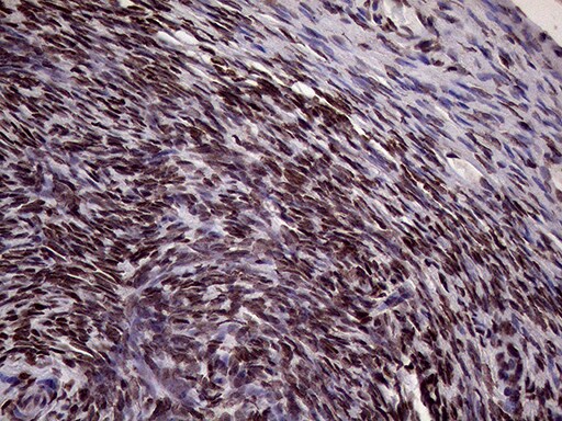 XRN2 Antibody (OTI5F4) Immunohistochemistry;XRN2 Antibody (OTI5F4)[NBP3-44953]-