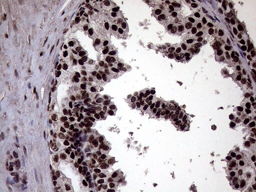 XRN2 Antibody (OTI5F4) Immunohistochemistry;XRN2 Antibody (OTI5F4)[NBP3-44953]-