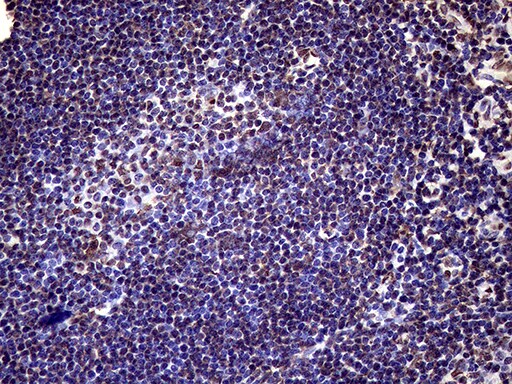 XRN2 Antibody (OTI5F4) Immunohistochemistry;XRN2 Antibody (OTI5F4)[NBP3-44953]-
