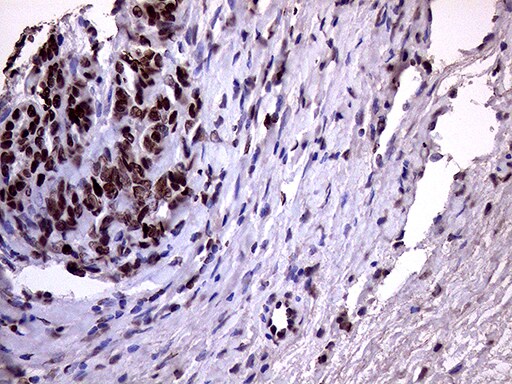 XRN2 Antibody (OTI5F4) Immunohistochemistry;XRN2 Antibody (OTI5F4)[NBP3-44953]-