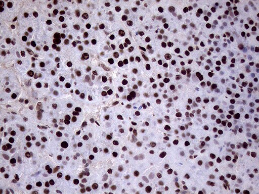 XRN2 Antibody (OTI5F4) Immunohistochemistry;XRN2 Antibody (OTI5F4)[NBP3-44953]-