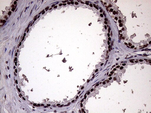 XRN2 Antibody (OTI5F4) Immunohistochemistry;XRN2 Antibody (OTI5F4)[NBP3-44953]-