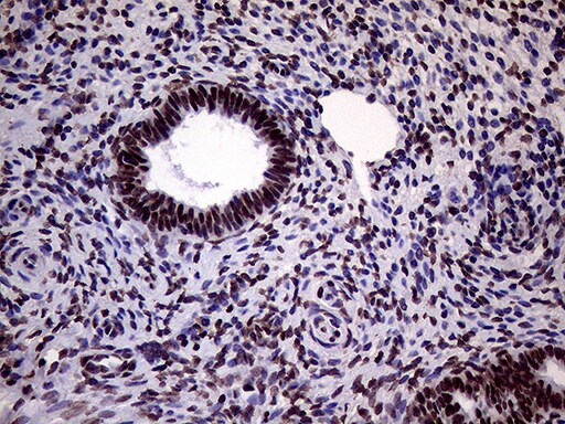 XRN2 Antibody (OTI5F4) Immunohistochemistry;XRN2 Antibody (OTI5F4)[NBP3-44953]-