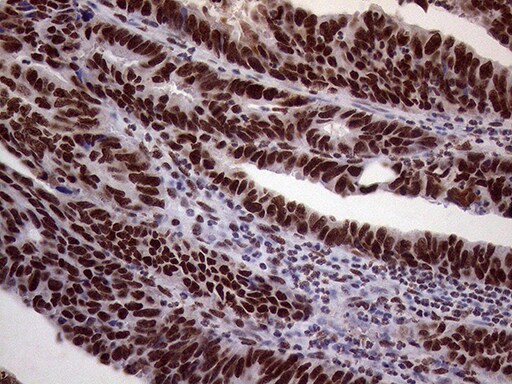XRN2 Antibody (OTI5F4) Immunohistochemistry;XRN2 Antibody (OTI5F4)[NBP3-44953]-