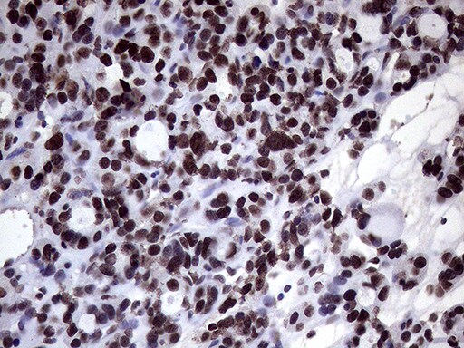 XRN2 Antibody (OTI5F4) Immunohistochemistry;XRN2 Antibody (OTI5F4)[NBP3-44953]-