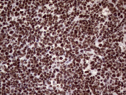 XRN2 Antibody (OTI5F4) Immunohistochemistry;XRN2 Antibody (OTI5F4)[NBP3-44953]-