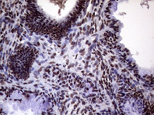 XRN2 Antibody (OTI5F4) Immunohistochemistry;XRN2 Antibody (OTI5F4)[NBP3-44953]-