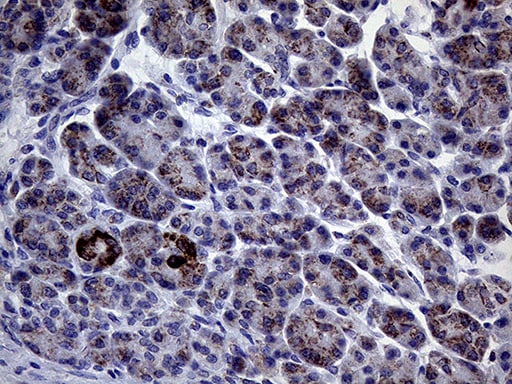 CLIP4 Antibody (OTI5D10)