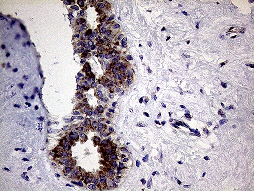 CLIP4 Antibody (OTI5D10) Immunohistochemistry;CLIP4 Antibody (OTI5D10)[NBP3-44957]-