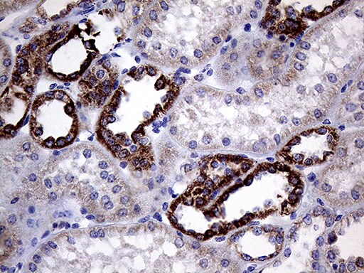 CLIP4 Antibody (OTI5D10) Immunohistochemistry;CLIP4 Antibody (OTI5D10)[NBP3-44957]-