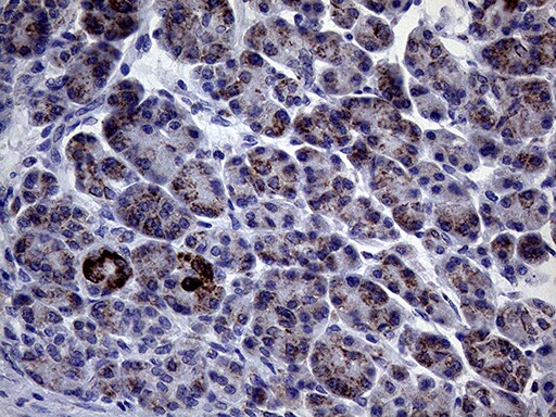 CLIP4 Antibody (OTI5D10) Immunohistochemistry;CLIP4 Antibody (OTI5D10)[NBP3-44957]-