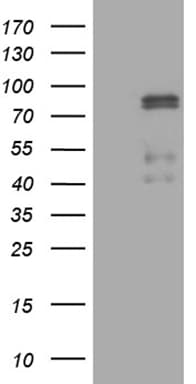 CLIP4 Antibody (OTI5D10)