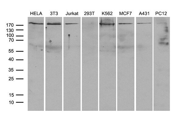 RhoGAP Antibody (OTI9H2) Western Blot;RhoGAP Antibody (OTI9H2)[NBP3-44958]-