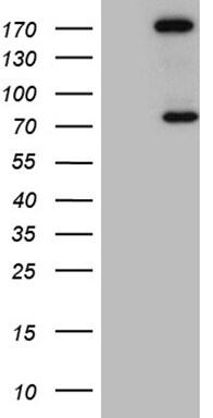 RhoGAP Antibody (OTI9H2) Western Blot;RhoGAP Antibody (OTI9H2)[NBP3-44958]-