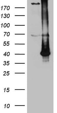 ASB13 Antibody (OTI3B2) Western Blot;ASB13 Antibody (OTI3B2)[NBP3-44959]-