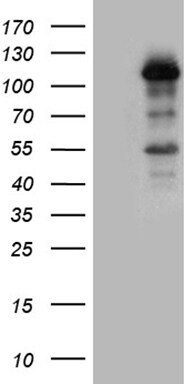 LONRF3 Antibody (OTI7F7) Western Blot;LONRF3 Antibody (OTI7F7)[NBP3-44961]-