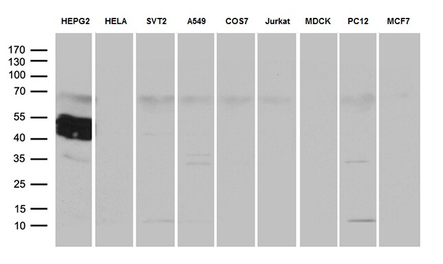ZCCHC17 Antibody (OTI1F11)