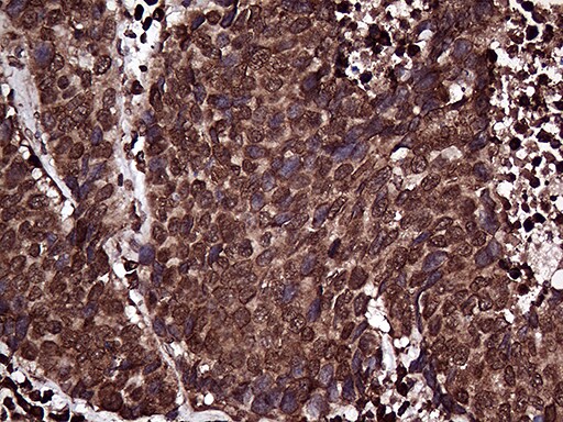 RPL10A Antibody (OTI2G9) Immunohistochemistry;RPL10A Antibody (OTI2G9)[NBP3-44967]-